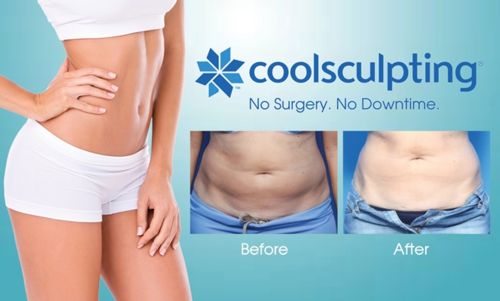 Image for Cool Sculpting